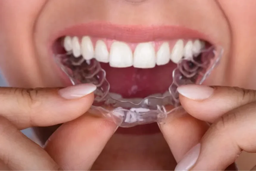 How Invisalign Works to Straighten Teeth Discreetly